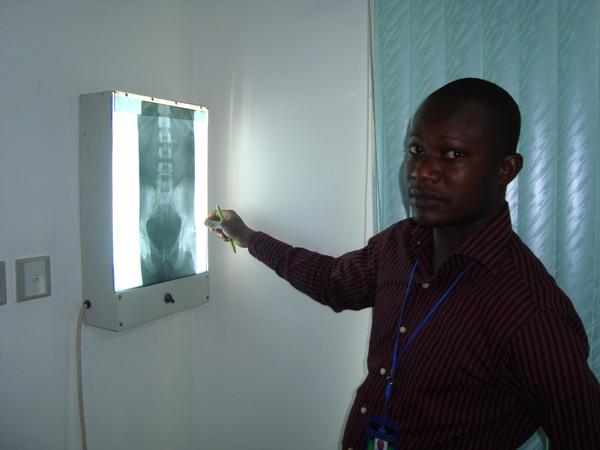 Radiographer reviewing an X-ray film